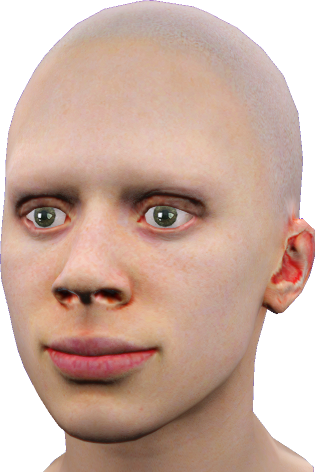 male 72